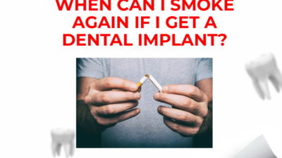 smoking after dental implant