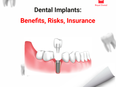 dental implant single day benefits