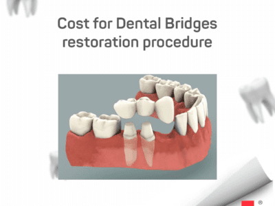cost of dental bridges in Inida