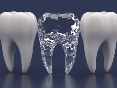diamond teeth implant