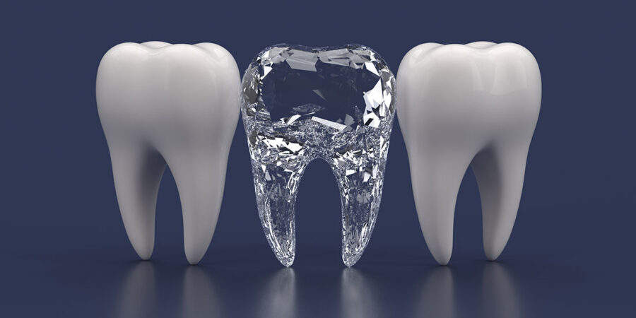 diamond teeth implant