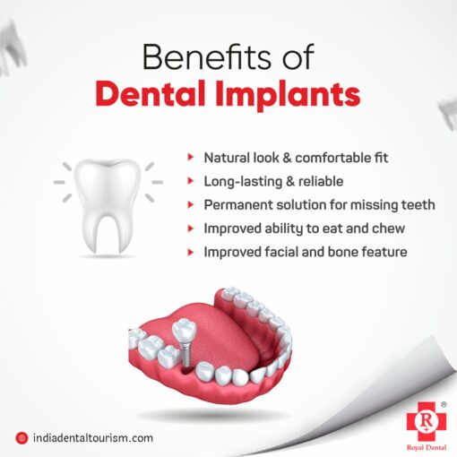 benefits of dental implants for missing teeth