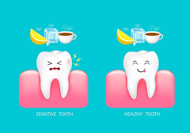 dental sensitivity in teeth