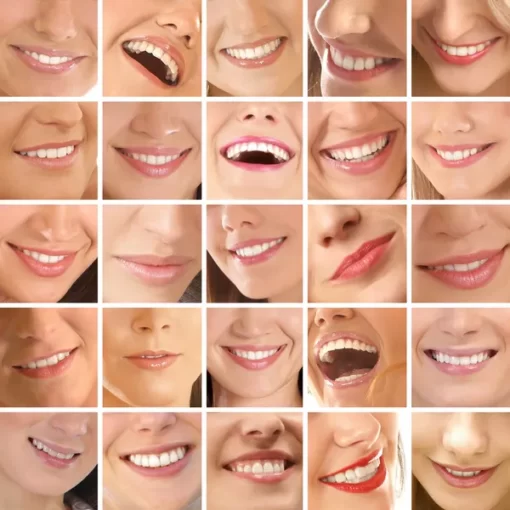 types of smiles teeth