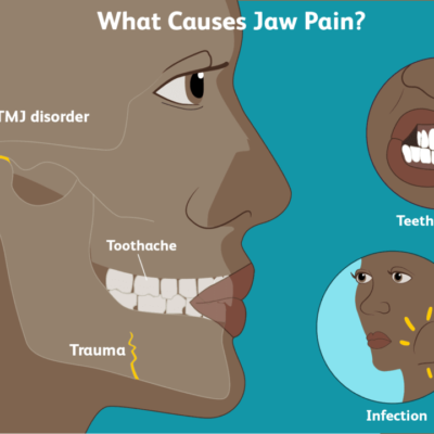 TMJ jaw pain