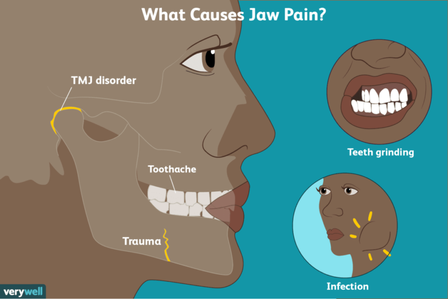 TMJ jaw pain oral health