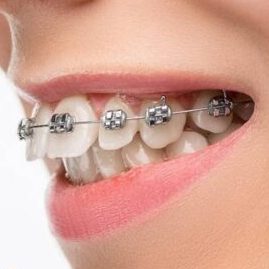 braces cosmetic dentistry, oral health