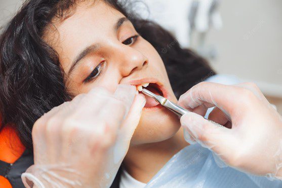 dental-probe - paediatric dentistry and its benefits