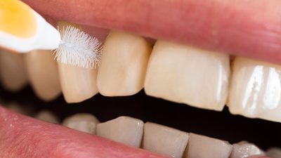 Proxy brush Anti-Plaque