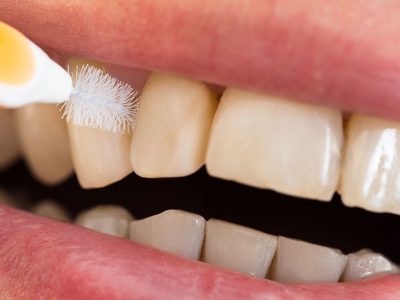 Proxy brush Anti-Plaque