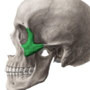 zygomatic implant bone