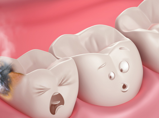 tooth decay cavities,(ayurvedic)