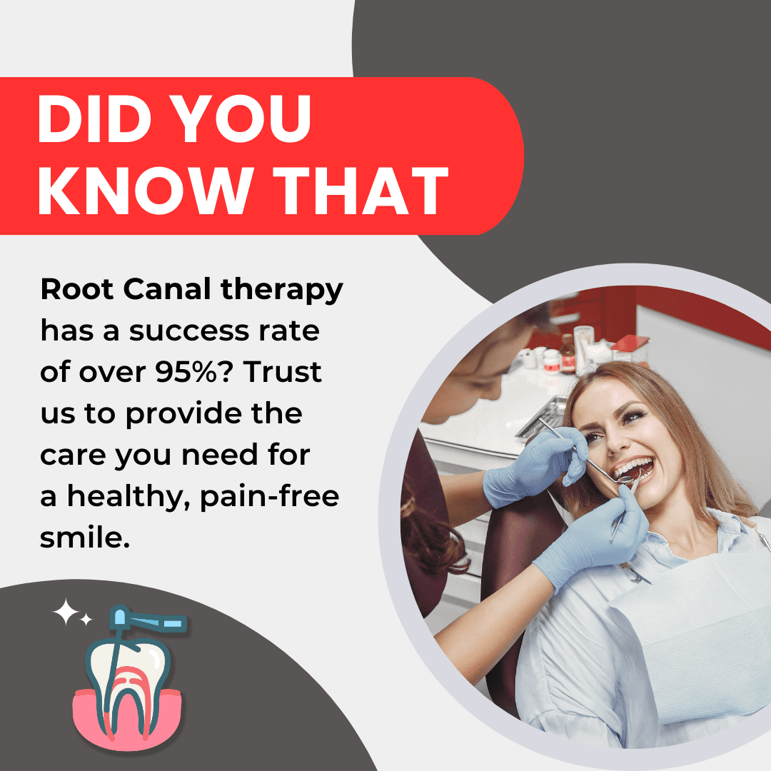Root Canal Treatment Success