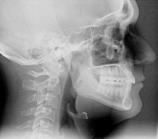 Extraoral x-rays near me | Royal Dental Care in Mumbai