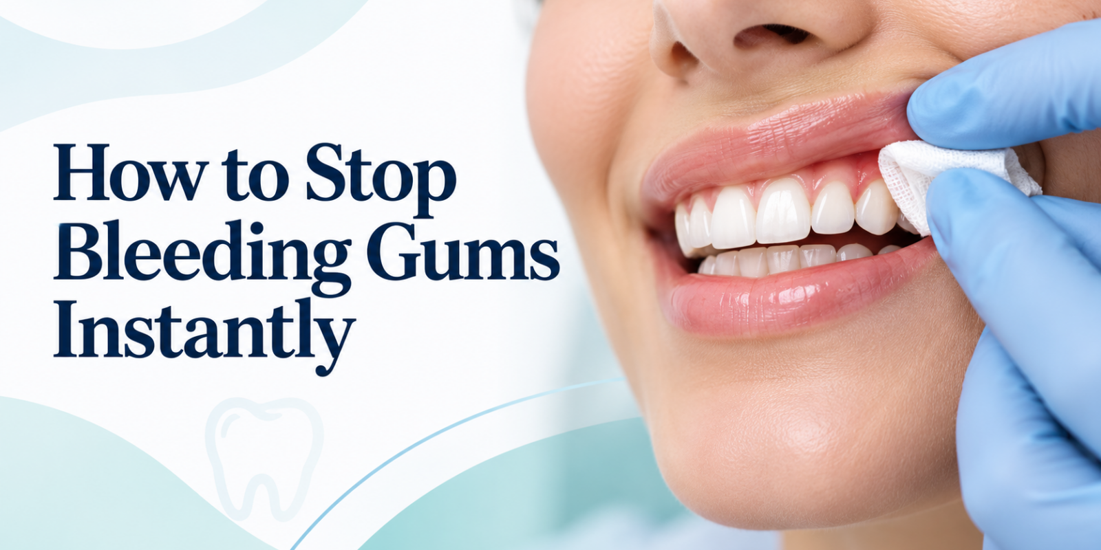 5 Reasons Why We Have Bleeding Gums and How to Prevent It Royal Dental Clinics Stop Bleeding Gums
