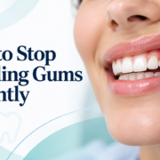 How to Stop Bleeding Gums Instantly: A Step-by-Step Guide Royal Dental Clinics Stop Bleeding Gums