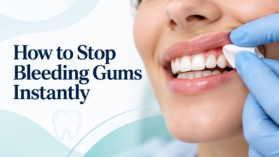 Stop Bleeding Gums