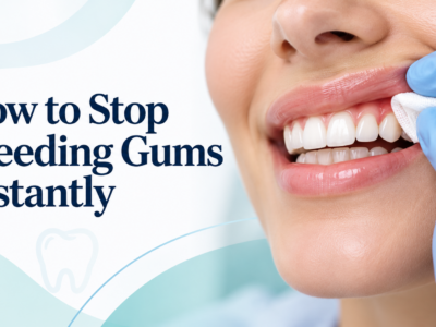 Stop Bleeding Gums