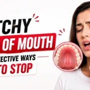 Itchy Roof of Mouth - Effective Ways To Stop Royal Dental Clinics Itchy Roof of Mouth – Effective Ways To Stop