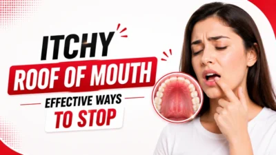 Itchy Roof of Mouth – Effective Ways To Stop