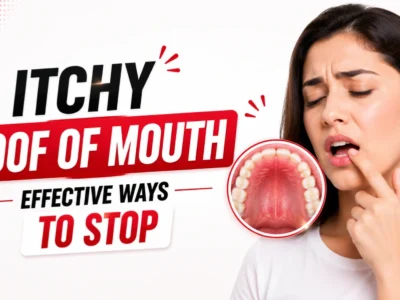Itchy Roof of Mouth – Effective Ways To Stop