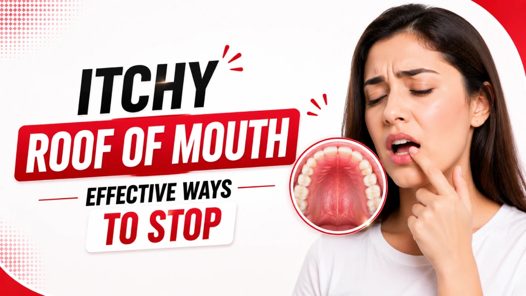 Itchy Roof of Mouth - Effective Ways To Stop Royal Dental Clinics Itchy Roof of Mouth – Effective Ways To Stop