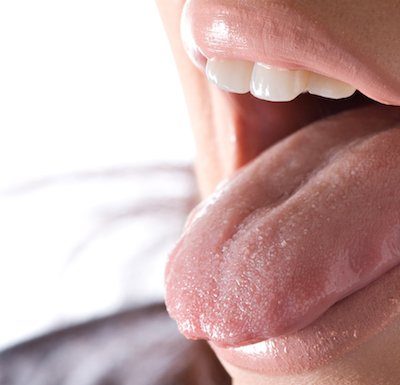 scalloped tongue oral surgery