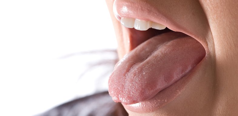 scalloped tongue oral surgery