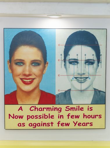 facial symmetry