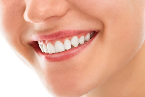 celebrity smile makeover | Royal smile dental care