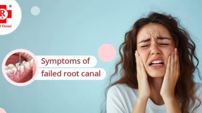 Root canal treatment near me | Royal dental care in Mumbai