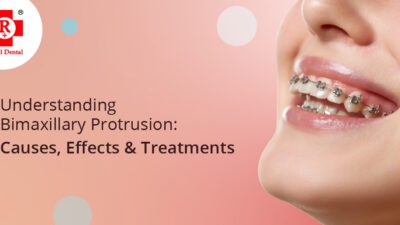 Bimaxillary Protrusion: Impact on Facial Aesthetics & Treatment Options in kandivali, Mumbai