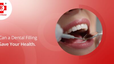 Can a Dental Filling Save Your Health?