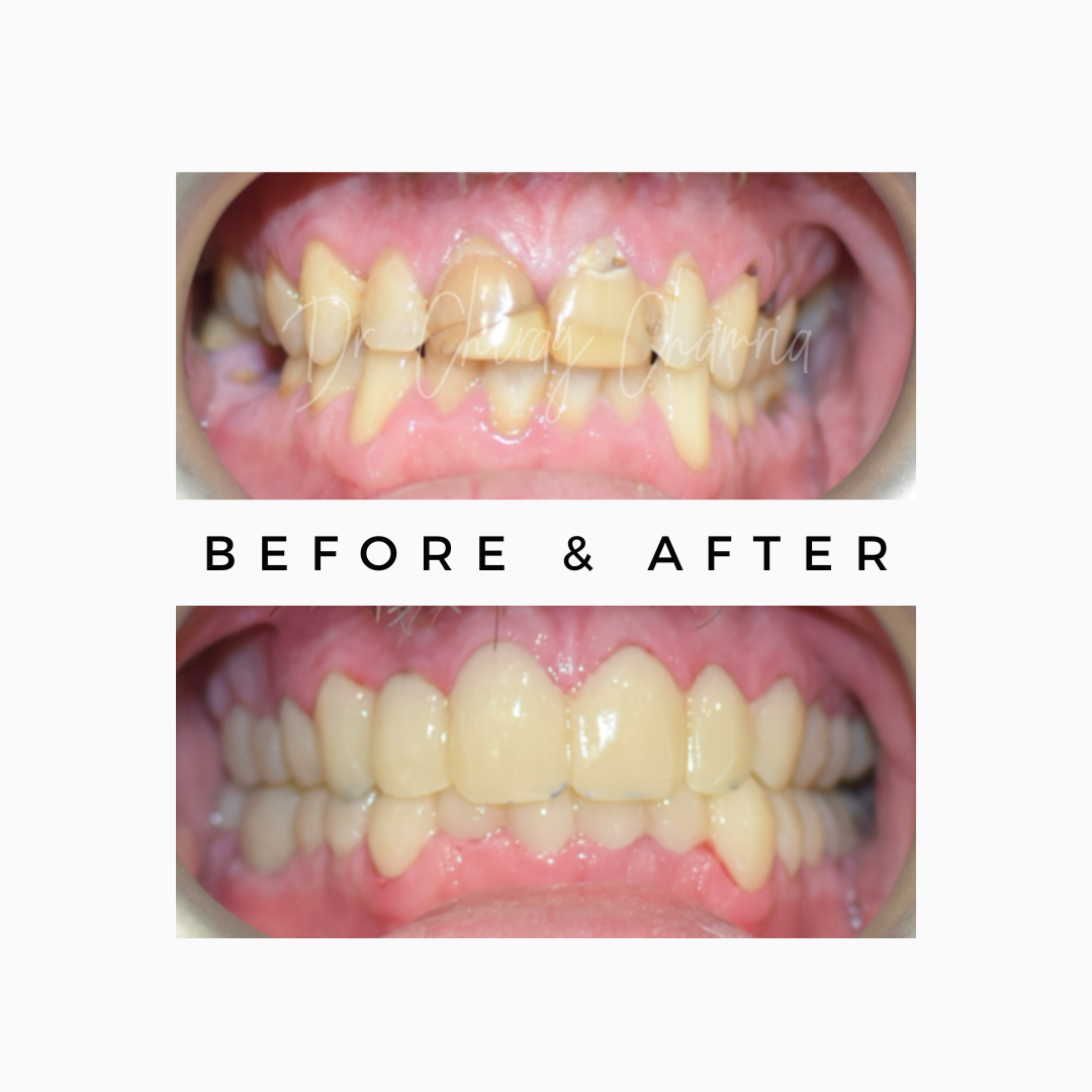 Royal Dental Clinics Smile makeover