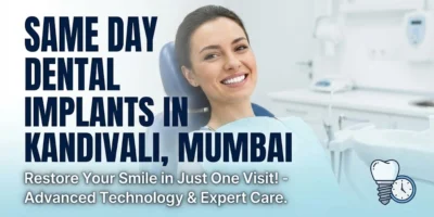 Same Day Dental Implants in Kandivali Mumbai