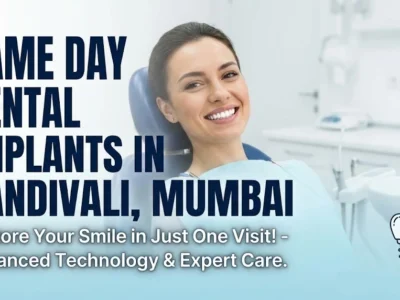 Same Day Dental Implants in Kandivali Mumbai