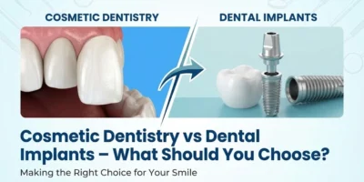 Cosmetic Dentistry in Kandivali vs Dental Implants in Kandivali – What Should You Choose?