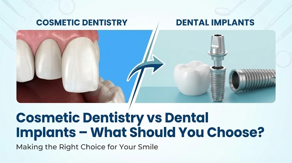Cosmetic Dentistry in Kandivali vs Dental Implants in Kandivali – What Should You Choose?
