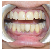 Royal Dental Clinics: Top 5 Dental Case Studies Royal Dental Clinics Royal Dental Clinics Mumbai | Top Dentist in Kandivali