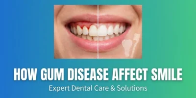 How Gum Disease Affect Smile