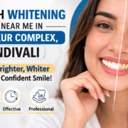 royal implant teeth whitening kandivali