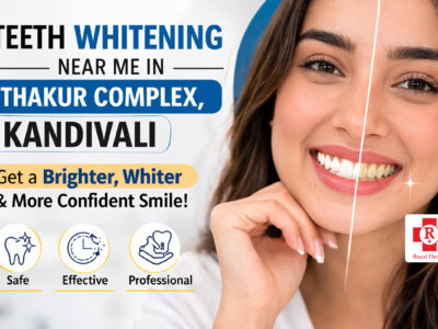 royal implant teeth whitening kandivali