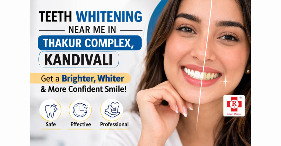 How to manage Sensitivity after Teeth Whitening? Royal Dental Clinics royal implant teeth whitening kandivali