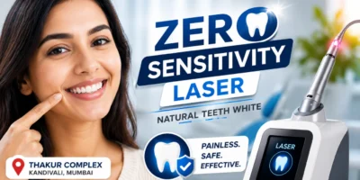 Natural teeth white in Thakur complex kandivali Mumbai