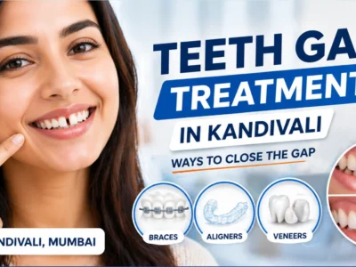 Teeth Gap Treatment In Kandivali