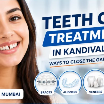 Teeth Gap Treatment In Kandivali