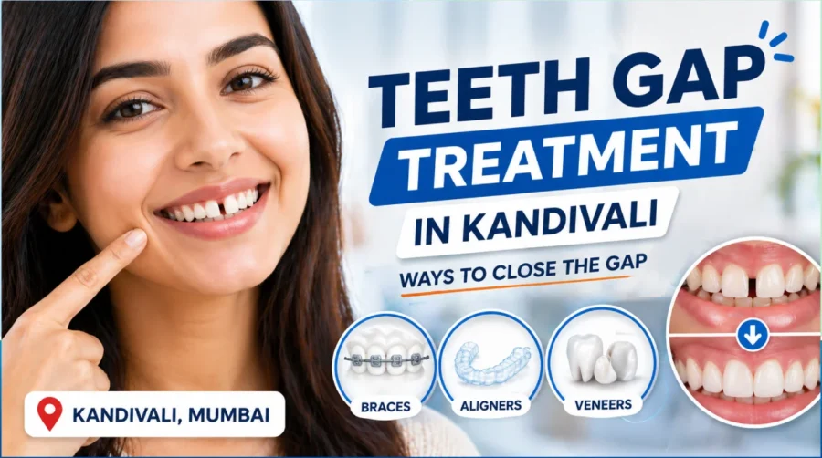 Rising Culture of Cosmetic Dentistry: Why It’s More Popular Now Royal Dental Clinics Teeth Gap Treatment In Kandivali