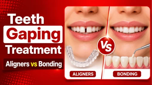 Teeth Gaping Treatment in Kandivali Mumbai