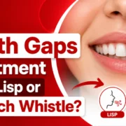 Do Teeth Gaps Treatment fix a lisp or speech whistle?