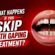 What happens if I skip Teeth Gaping Treatment In Kandivali, Mumbai and let the gap grow?